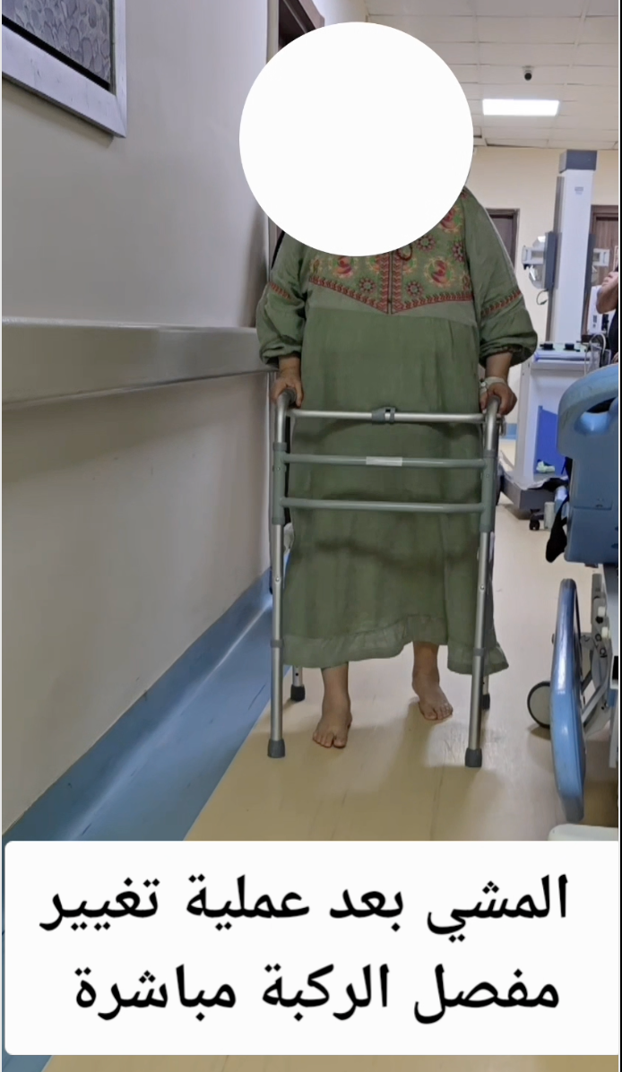 المشي بعد عملية تغيير مفضل الركبة